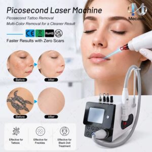 BEST Q Switched ND Yag Laser Tattoo Removal machine 755nm 1064nm 532nm 1320nm Pico Laser Machine Lighten Freckles Renew Skin