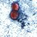 Diarrhea-causing parasite that can contaminate raw produce causing misery across several states Diarrhea-causing parasite that can contaminate raw produce causing misery across several states