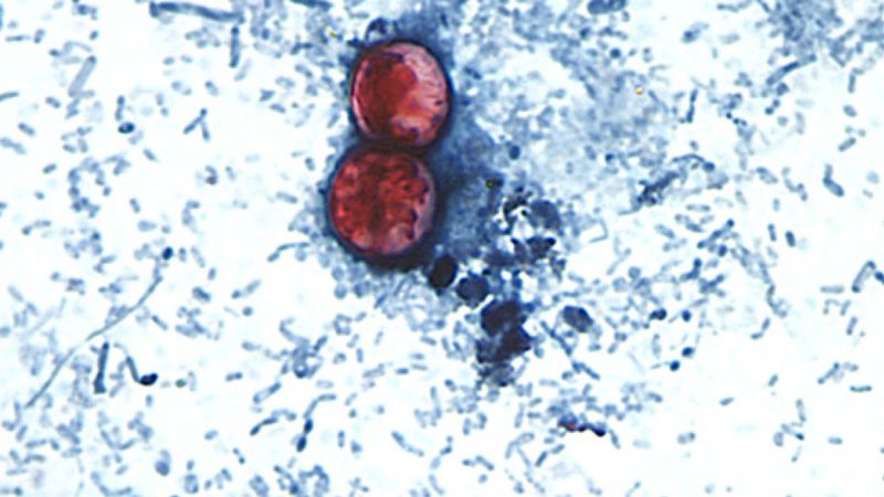 Diarrhea-causing parasite that can contaminate raw produce causing misery across several states Diarrhea-causing parasite that can contaminate raw produce causing misery across several states